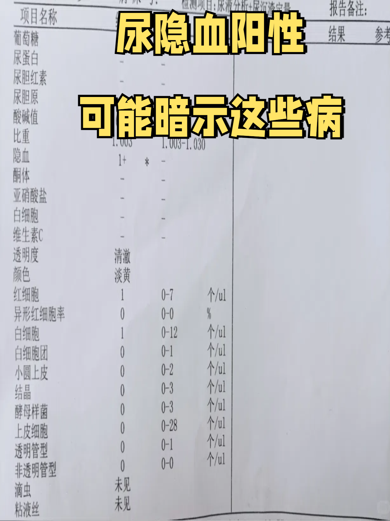 无锡排查出7名阳性感染者(无锡排查出7名阳性感染者是哪里的) 无锡排查出7名阳性感染者(无锡排查出7名阳性感染者是哪里的)