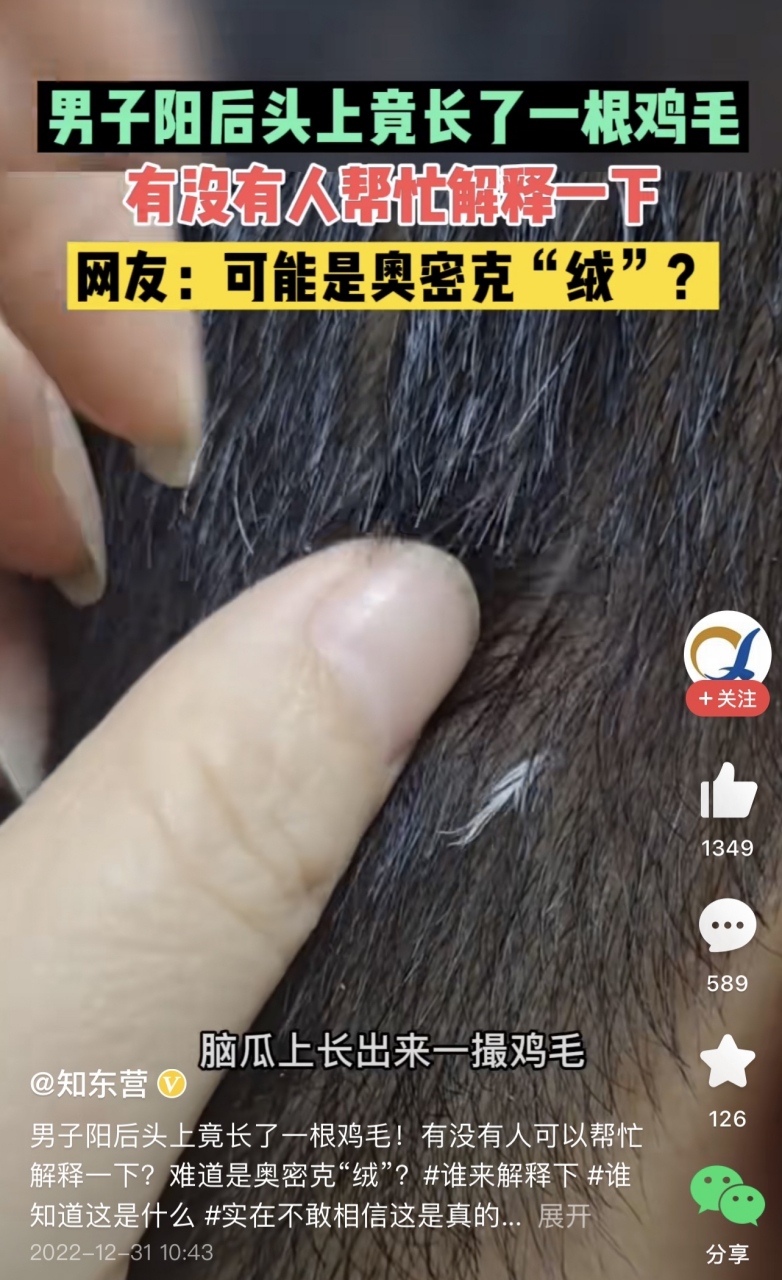 大连1例阳性系感染奥密克戎(大连新增一例本土确诊病例密切接触者)