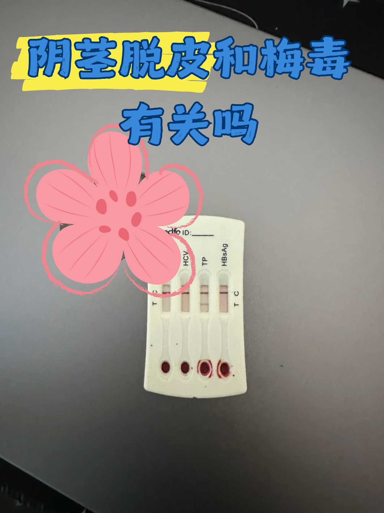 大连1例阳性系感染奥密克戎(大连新增一例本土确诊病例密切接触者)