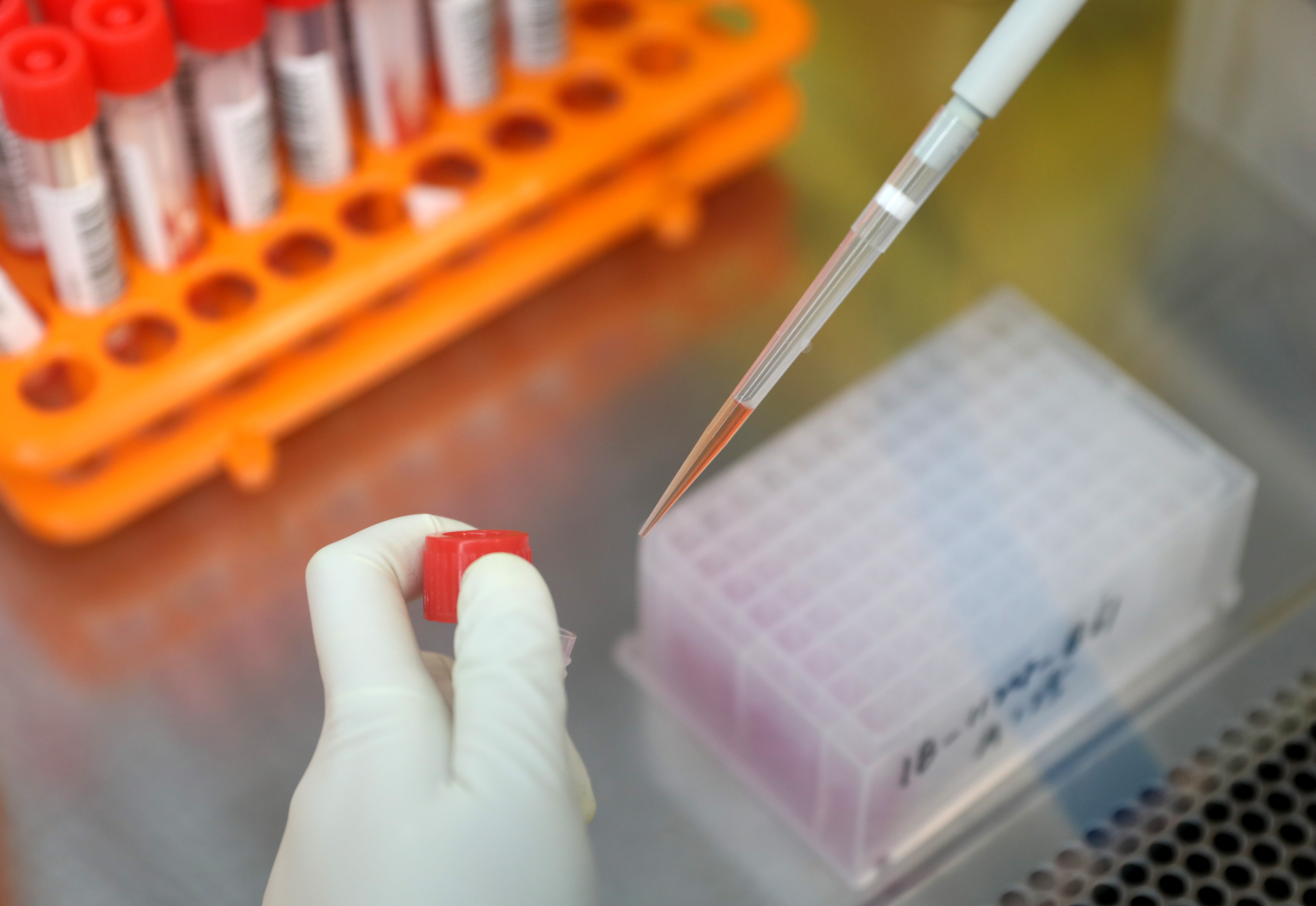 北京新增62例感染者(北京新增62例感染者轨迹)