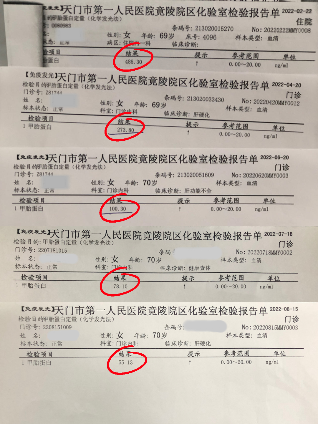 31省新增82例确诊(31省市新增最新消息)
