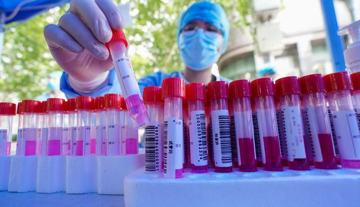 江苏江阴连续5轮参加全员核酸奖100(江阴全市核酸检测)