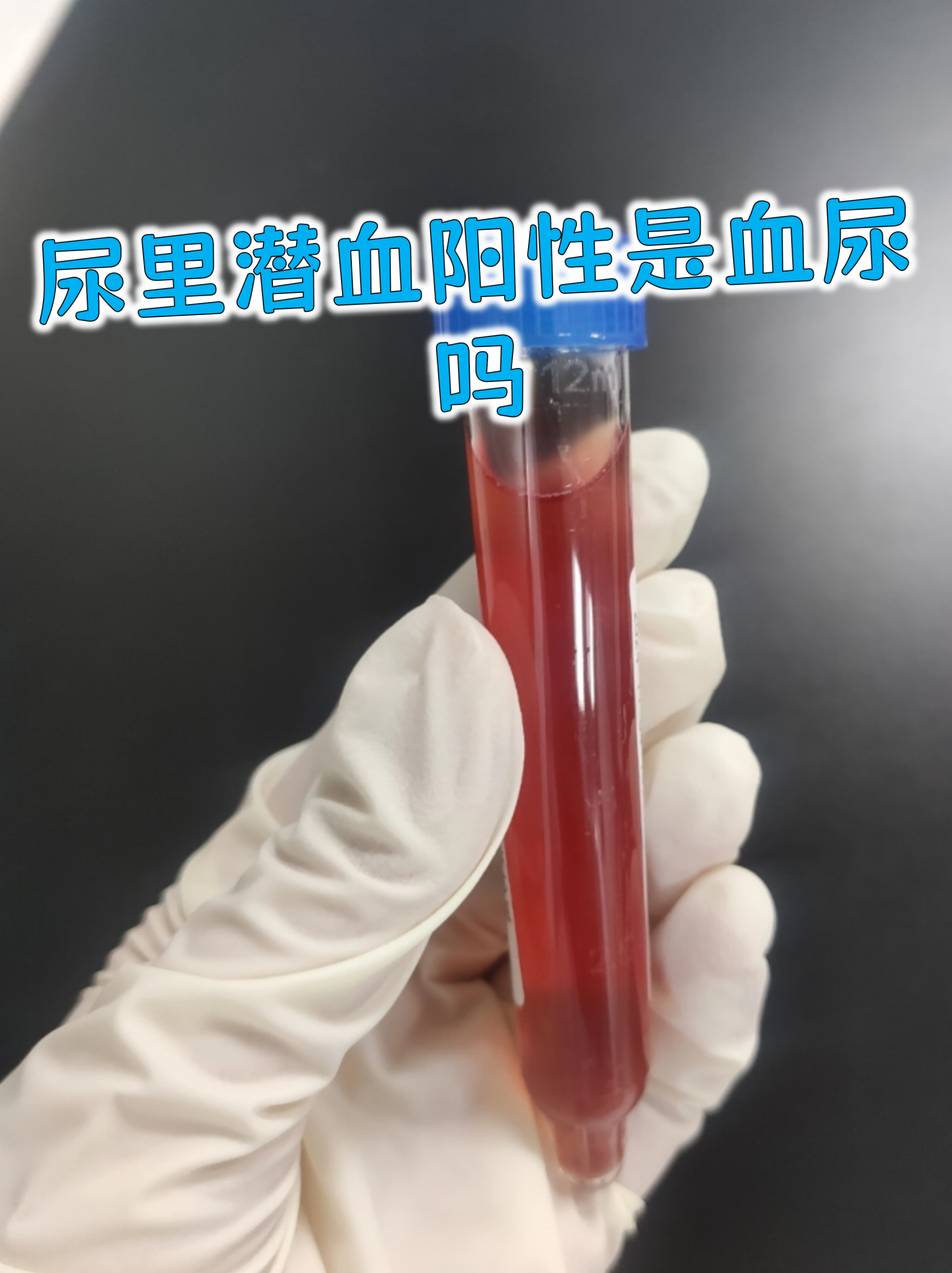 男子78次检测全阳性(73人阳性)