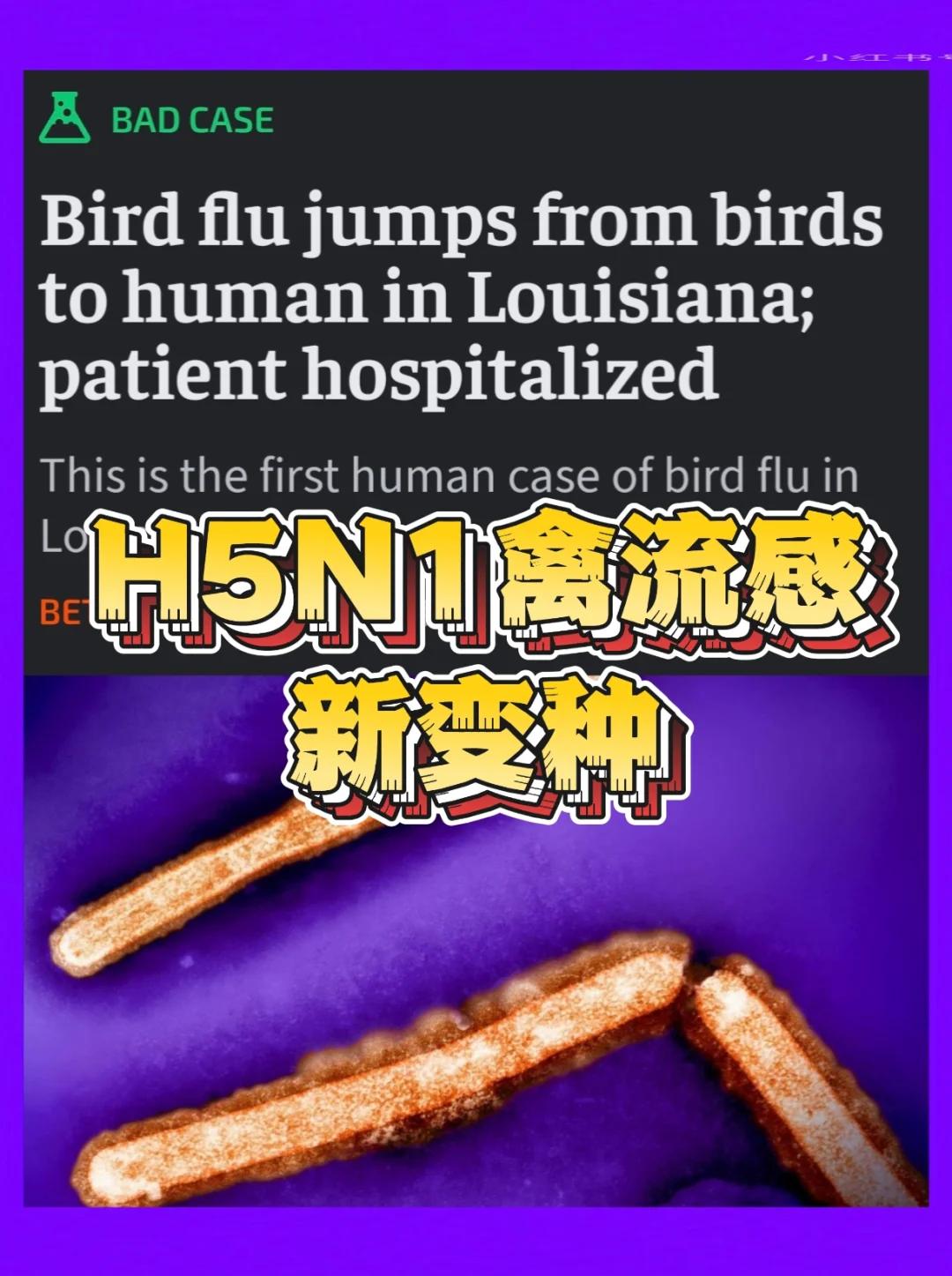 美国感染超公布数据(美国感染病例) 美国感染超公布数据(美国感染病例)