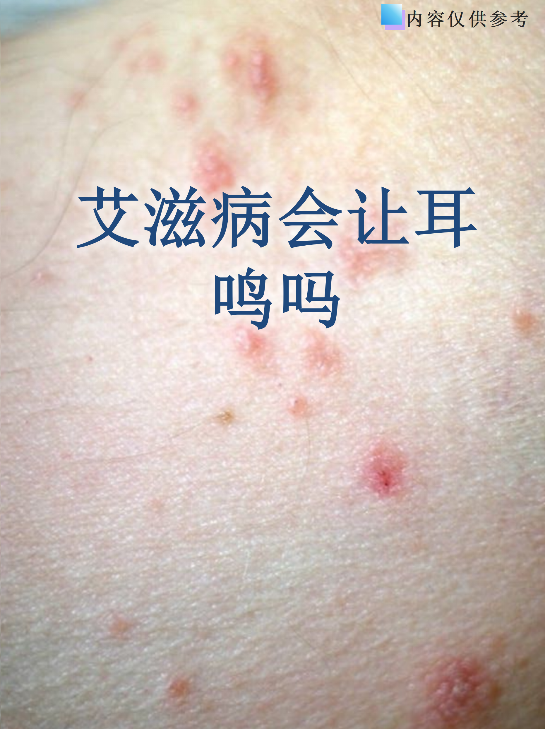 乌鲁木齐新增4例确诊44例无症状(乌鲁木齐新增18例)