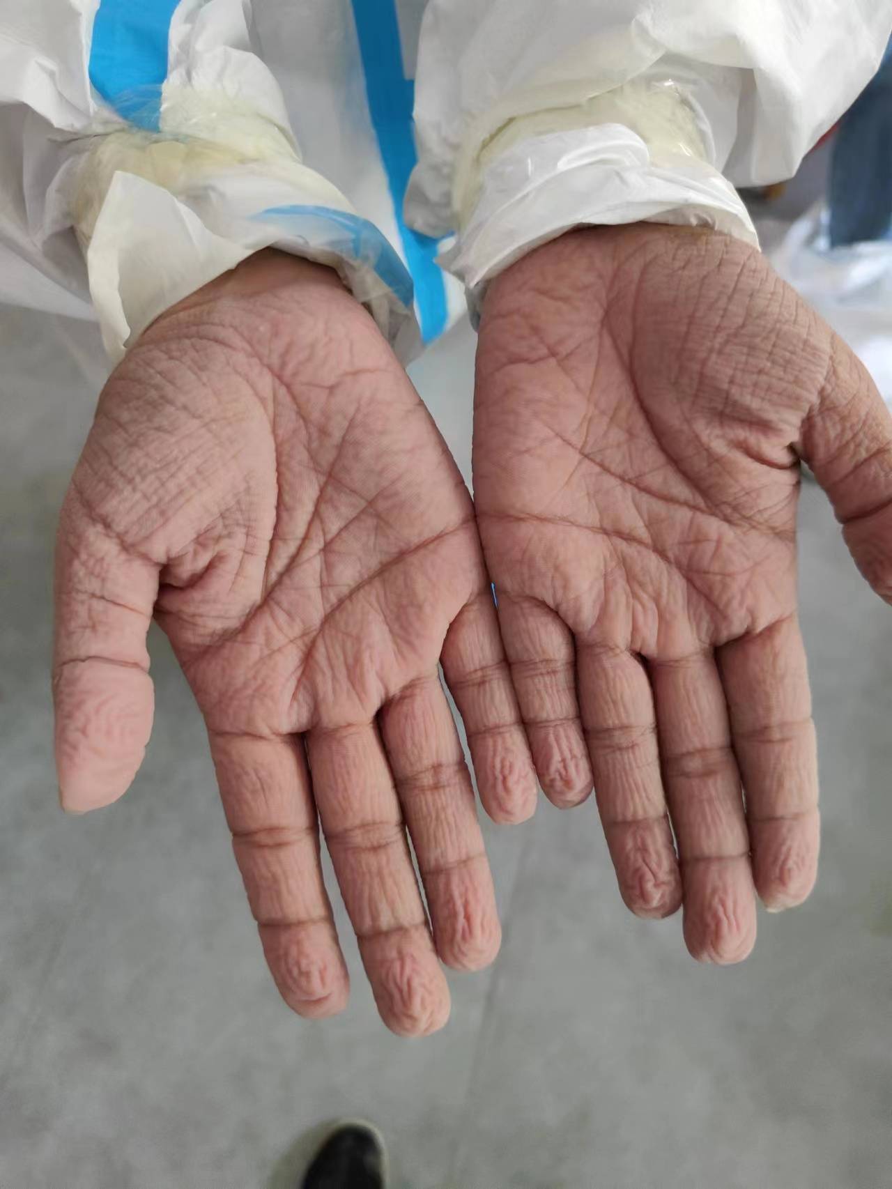 库尔勒疫情最新情况(库尔勒疫情防控最新消息今天) 库尔勒疫情最新情况(库尔勒疫情防控最新消息今天)