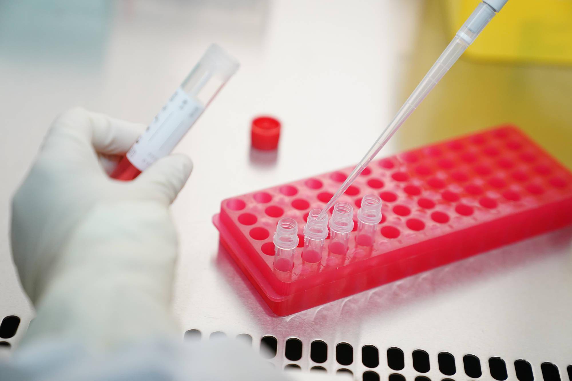 黑龙江新增3例本地确诊病例(黑龙江新增本土确诊病例3例活动轨迹) 黑龙江新增3例本地确诊病例(黑龙江新增本土确诊病例3例活动轨迹)